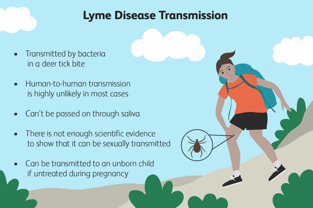 is lyme disease contagious 5186803 final 01 2652e075842d428b91a0ed17c10f261e